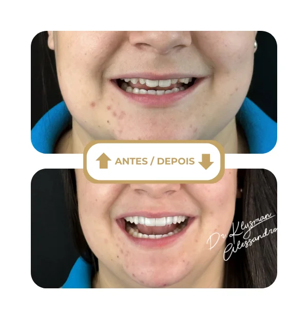 Resultado antes e depois 4