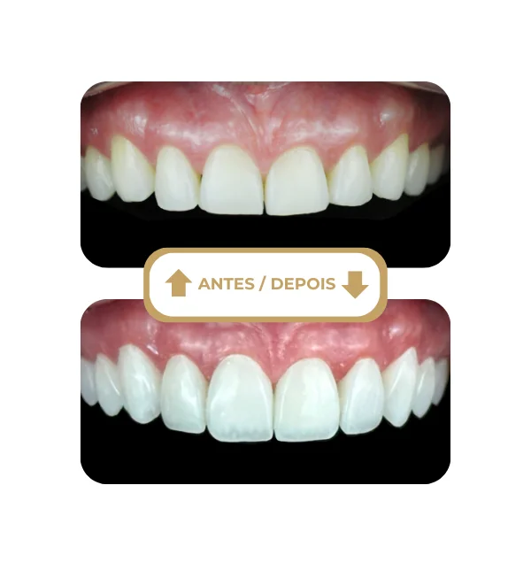 Resultado antes e depois 7