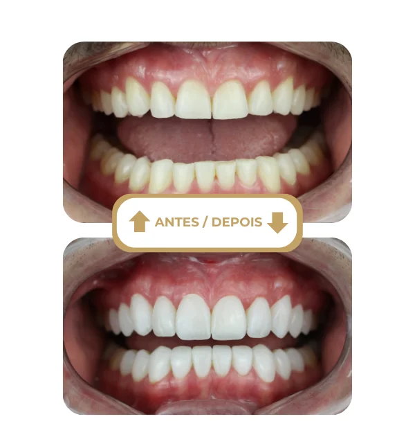 Resultado antes e depois 8